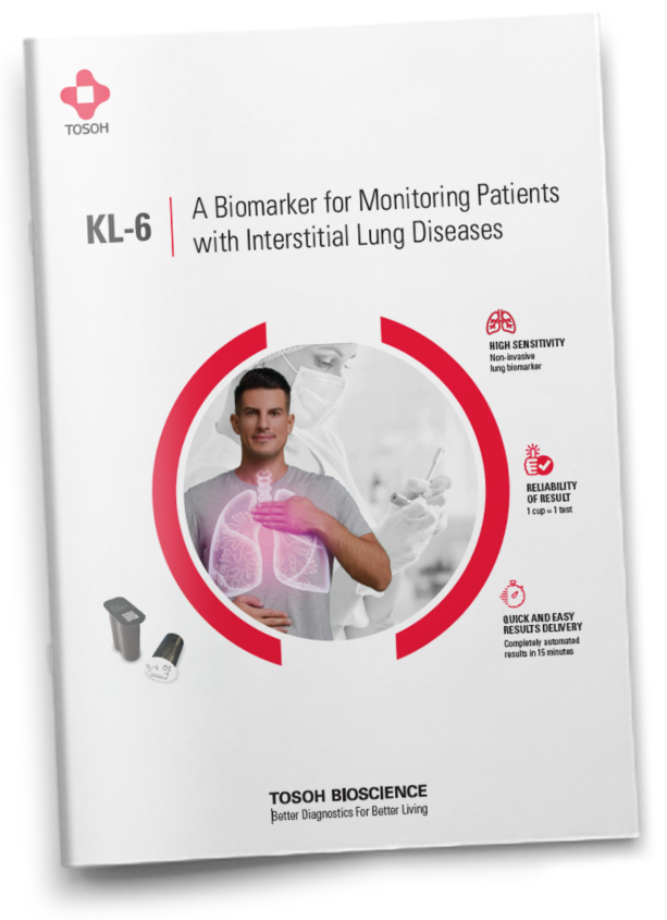 KL-6 - A Biomarker for Monitoring Patients with Interstitial Lung Diseases