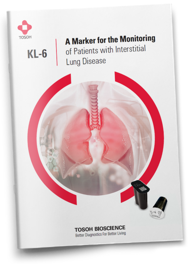 KL-6 - A Biomarker for the Monitoring Patients with Interstitial Lung Disease